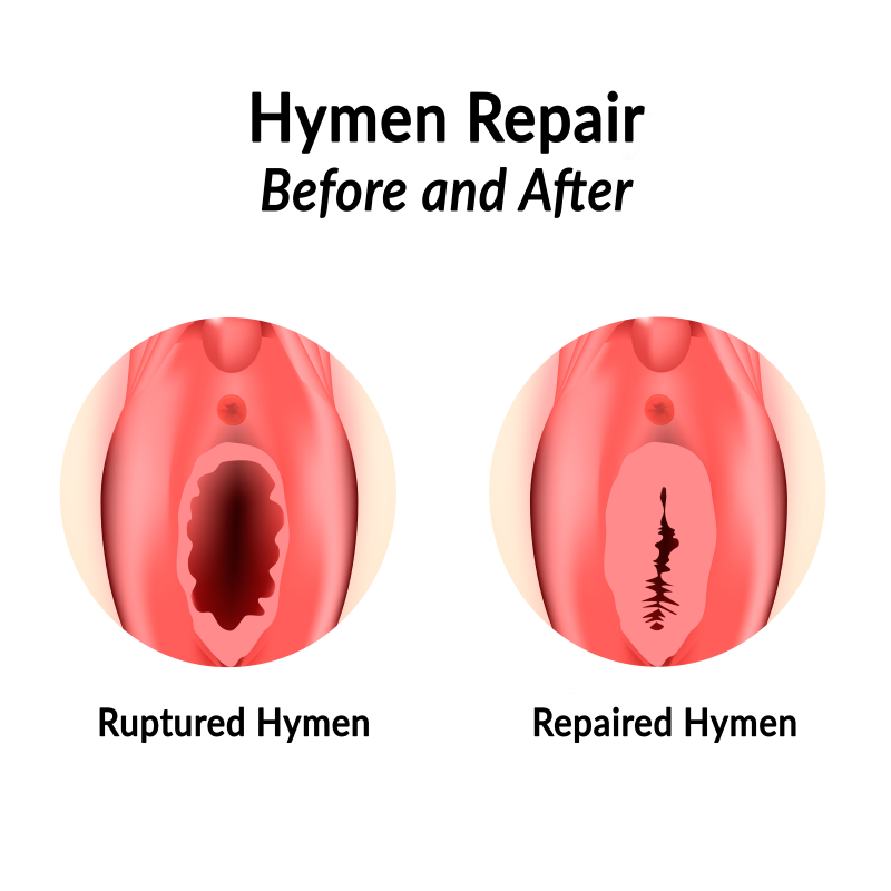 anne melnyk add photo breaking hymen with finger