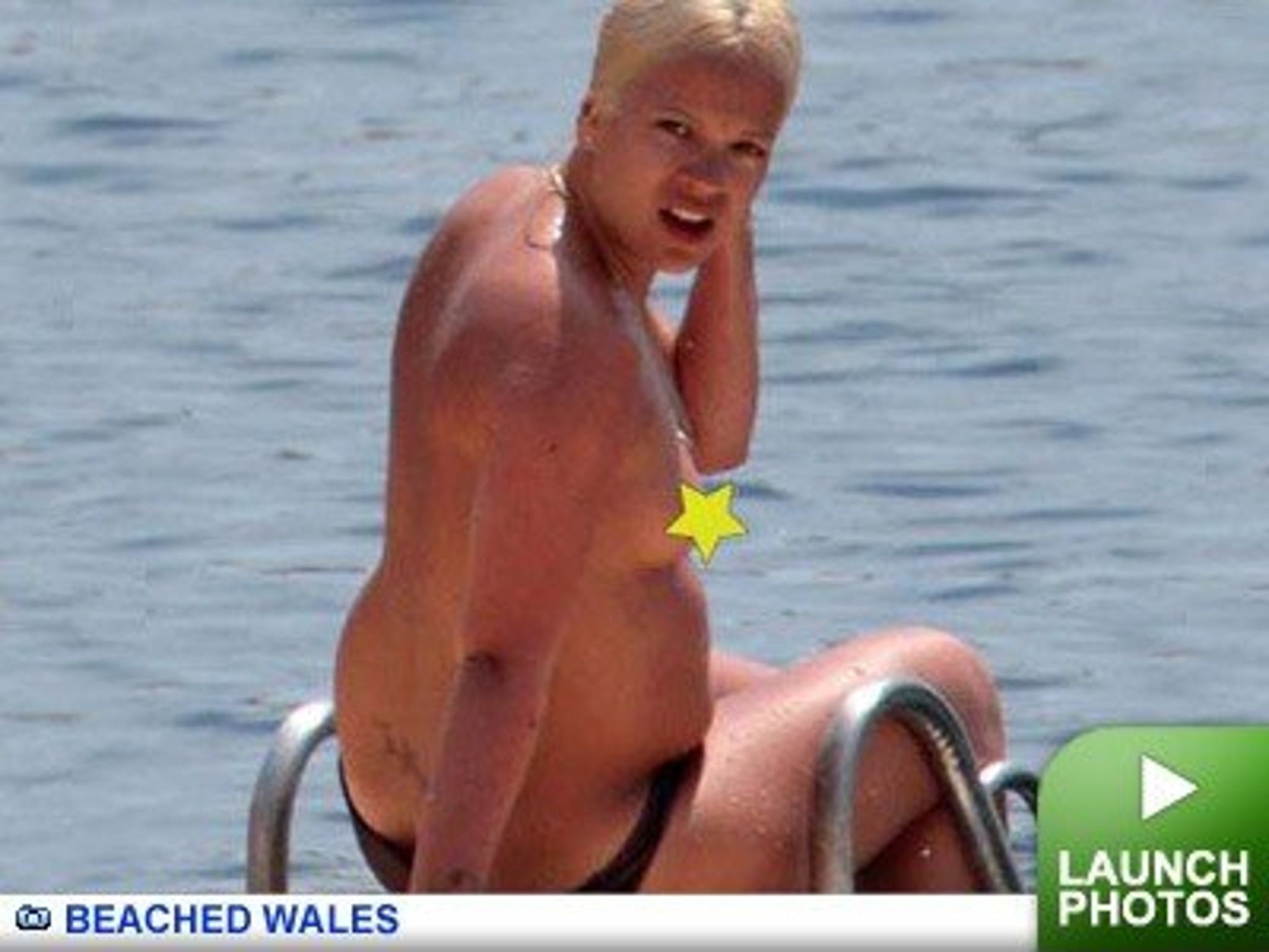 Lily Allen Naked anon v dinesh bairagi recommends Lily Allen Naked
