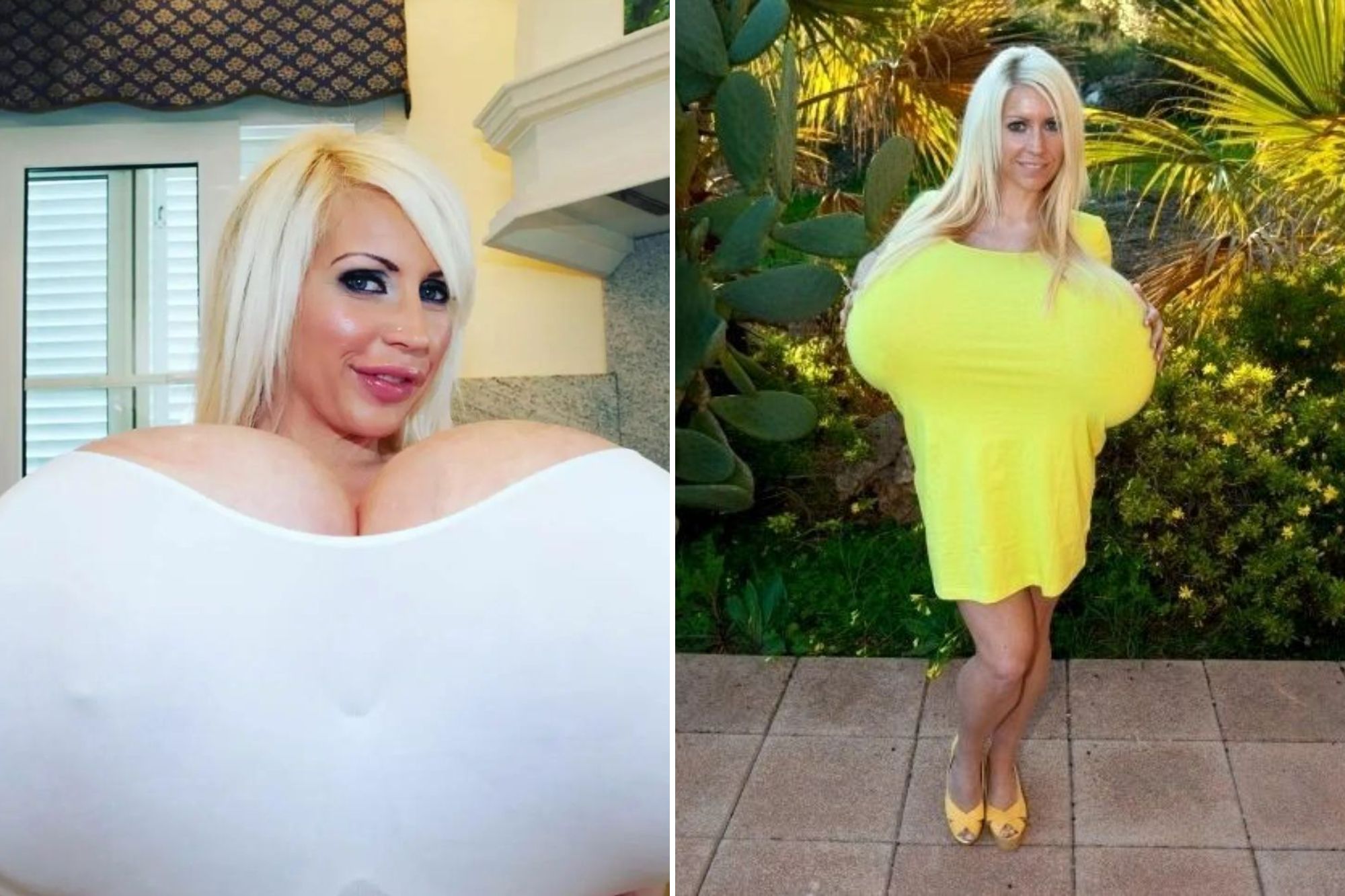 aleksandra krawczyk recommends beshine breasts pic
